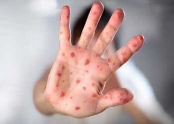 Foto: Reprodução/DGCI