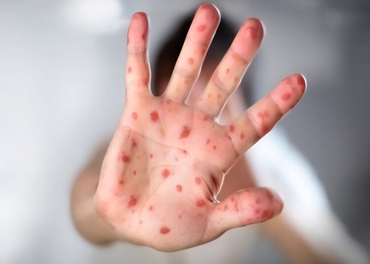 Foto: Reprodução/DGCI